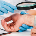 Understanding Common Skin Conditions Treated at a Skin Clinic