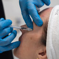 Exploring Skin Clinic Treatments for Dark Circles Under the Eyes