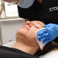 Understanding the Costs of Chemical Peels at Skin Clinics