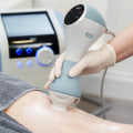 Exploring Cellulite Treatments at Skin Clinics: What You Need to Know