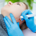 Understanding Mole Removal: The Role of Skin Clinics