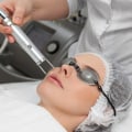 Exploring Laser Treatments at Skin Clinics: What You Need to Know