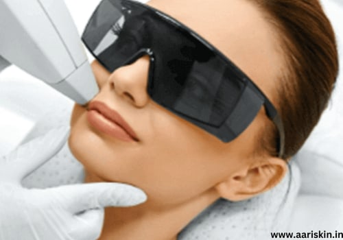 Understanding the Costs of Laser Hair Removal at Skin Clinics