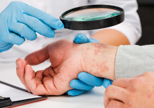 Understanding Common Skin Conditions Treated at a Skin Clinic