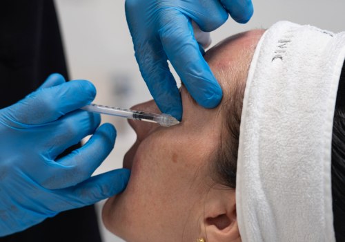 Exploring Skin Clinic Treatments for Dark Circles Under the Eyes