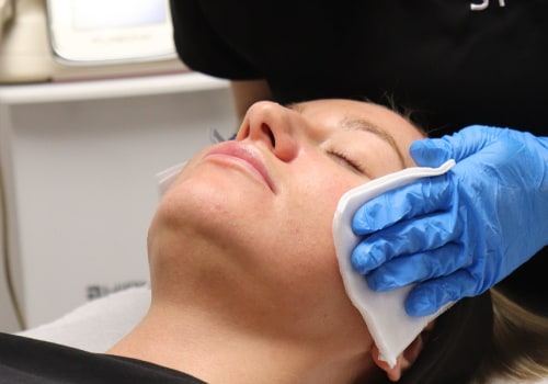 Understanding the Costs of Chemical Peels at Skin Clinics