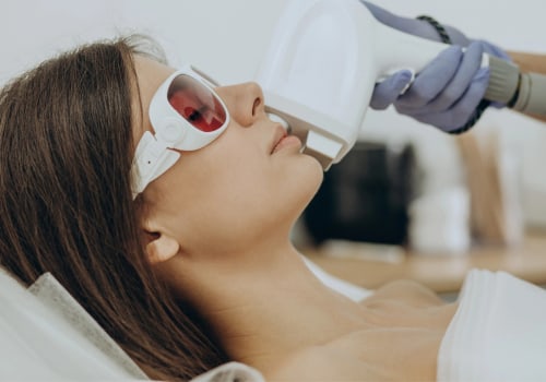 Understanding Recovery Times for Laser Treatments at Skin Clinics